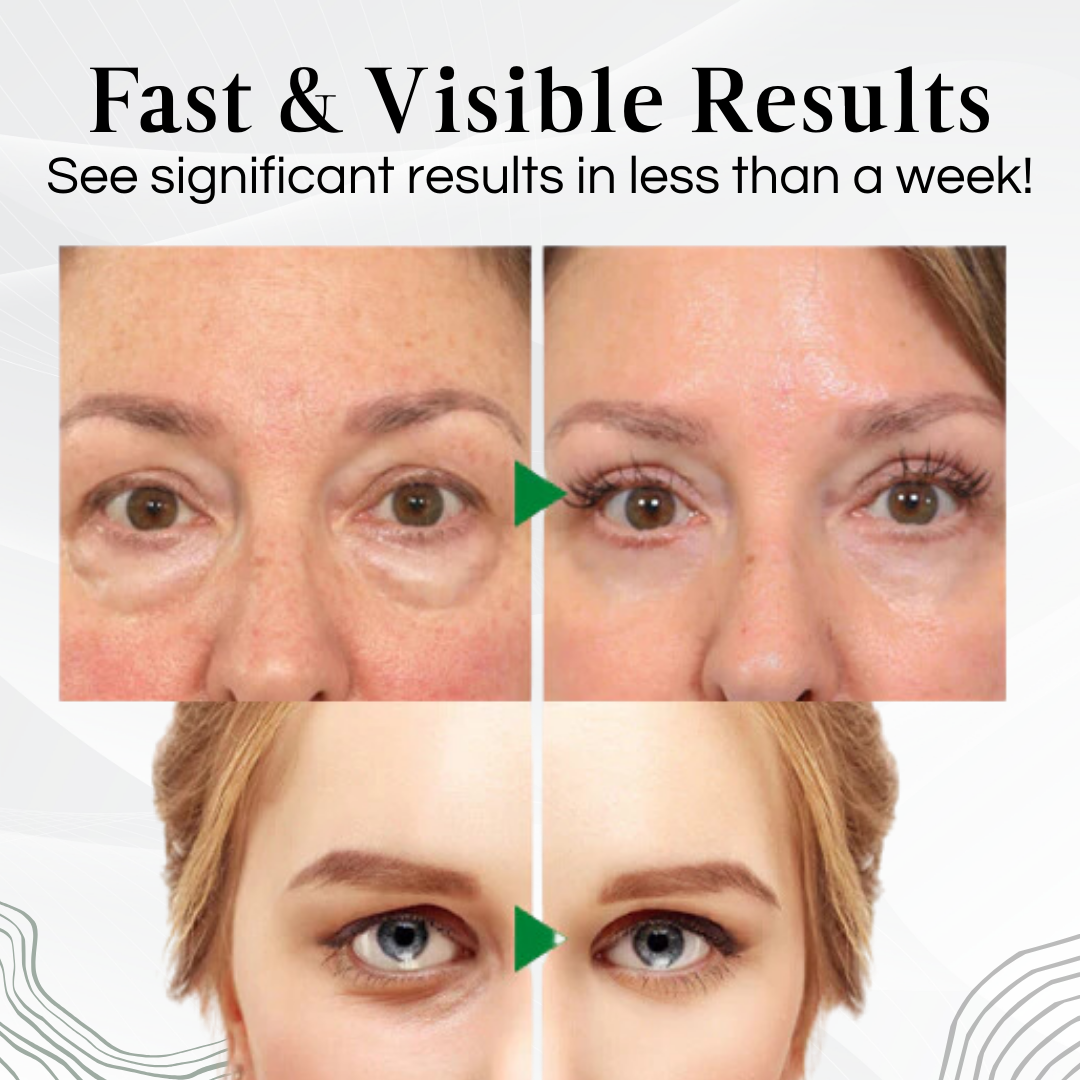 BEEYOUNG™ Eye Peptide Cream