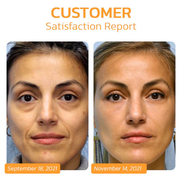 🎉 2025 Pre-Sale 70% ️🔥 UNPREE™ Kolirin Bee Venom Soluble Collagen Film