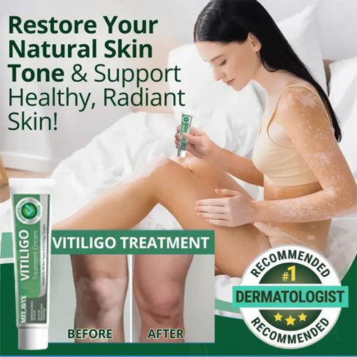 💥 2025 Hot Sale 70% OFF 🔥 Melavix Vitiligo Treatment Cream 🔆 Bring Balance Back to Your Skin
