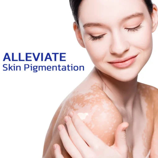 ๐ฅ 2025 Big Sale 70% OFF ๐ฅ Vitacure Antibacterial Vitiligo Cream ๐ Gentle Touch - Visible Change