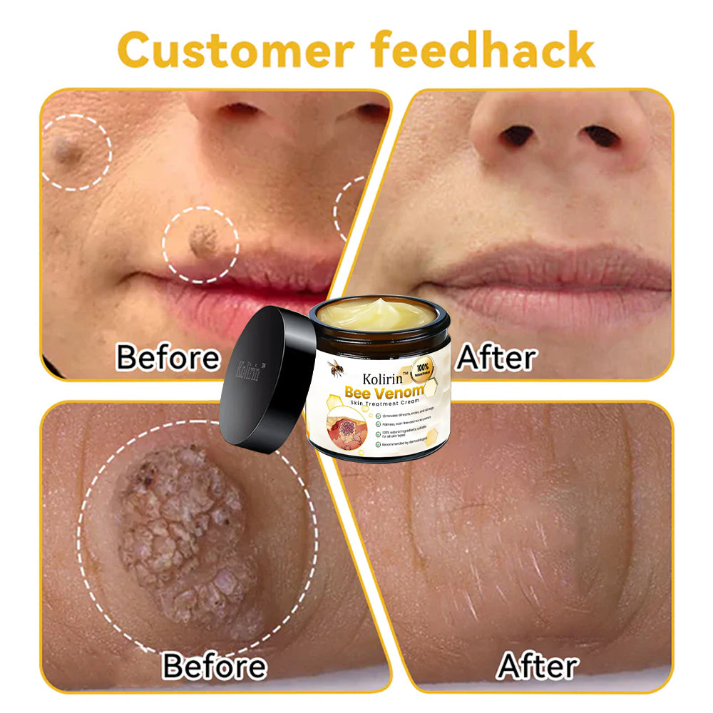 šKolirin⢠Bee Venom Skin Treatment Cream šæLimited Discounts š„