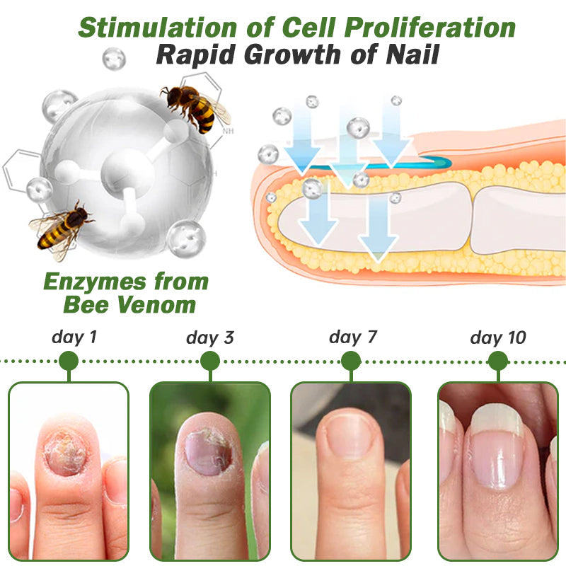 UNPREE ™ Kolirin Nail Defense Bee Venom Treatment Serum