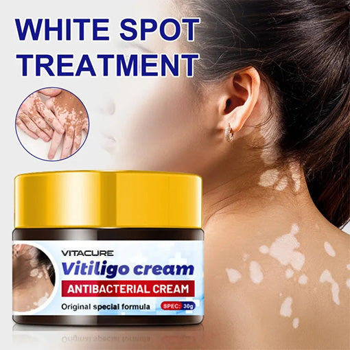 ๐ฅ 2025 Big Sale 70% OFF ๐ฅ Vitacure Antibacterial Vitiligo Cream ๐ Gentle Touch - Visible Change