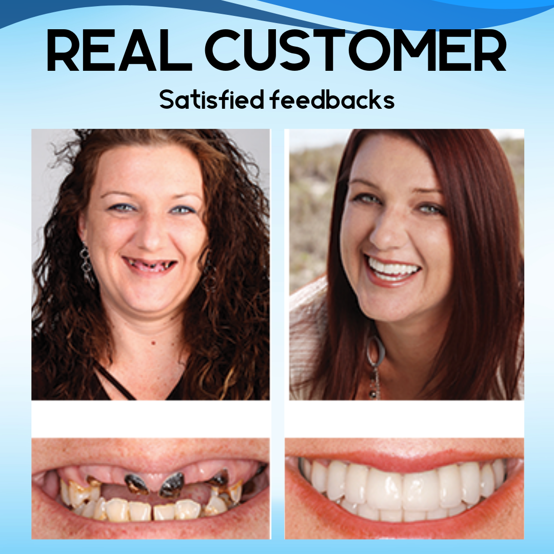 Suptruck⢠Silicone Reline Denture Set - Eat Freely, Smile Proudly š„ LAST DAY SALE 75% OFF š„
