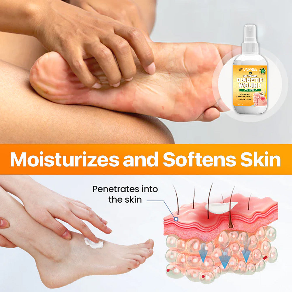 💥 2025 Limited 70% OFF ️⏳ UNPREE™ Bee Venom Diabetic Wound Kolirin Spray 💥 Fix Diabetic Wounds 100% in 2 Weeks