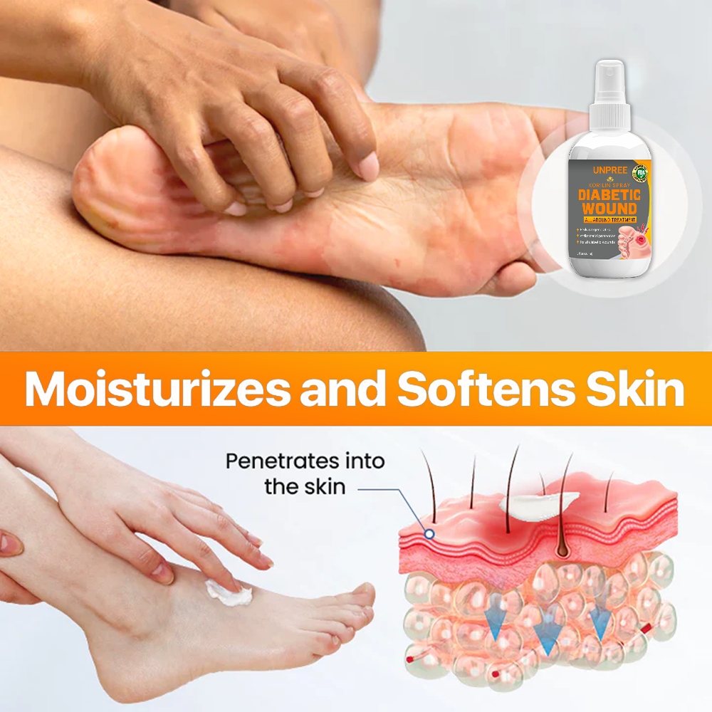 💥 2025 Limited 70% OFF ️⏳ UNPREE™ Kolirin Diabetic Wound Spray 💥 Fix Diabetic Wounds 100% in 2 Weeks