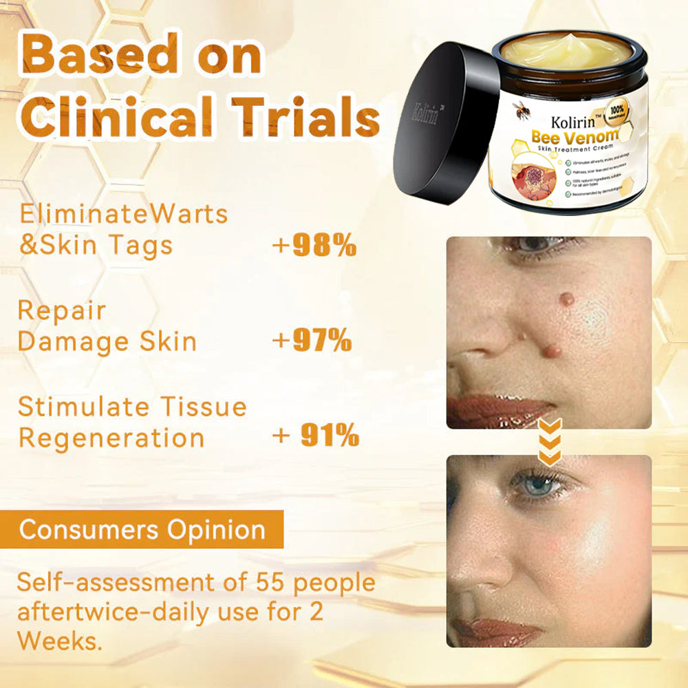 šKolirin⢠Bee Venom Skin Treatment Cream šæLimited Discounts š„