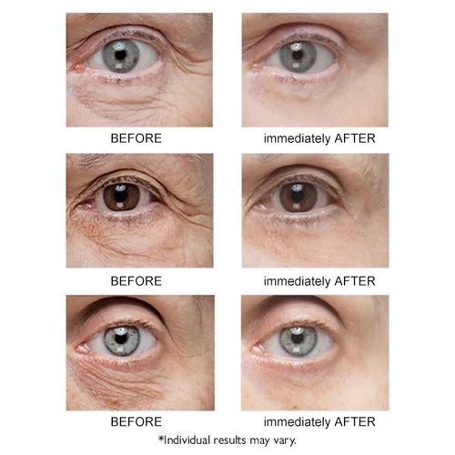 NoBags⢠Instant Firming Eye Tightener
