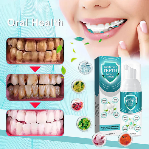 NiceSmile⢠TEETH Mouthwash - Solve All Oral Problems š„ LAST DAY SALE 70% OFF š„