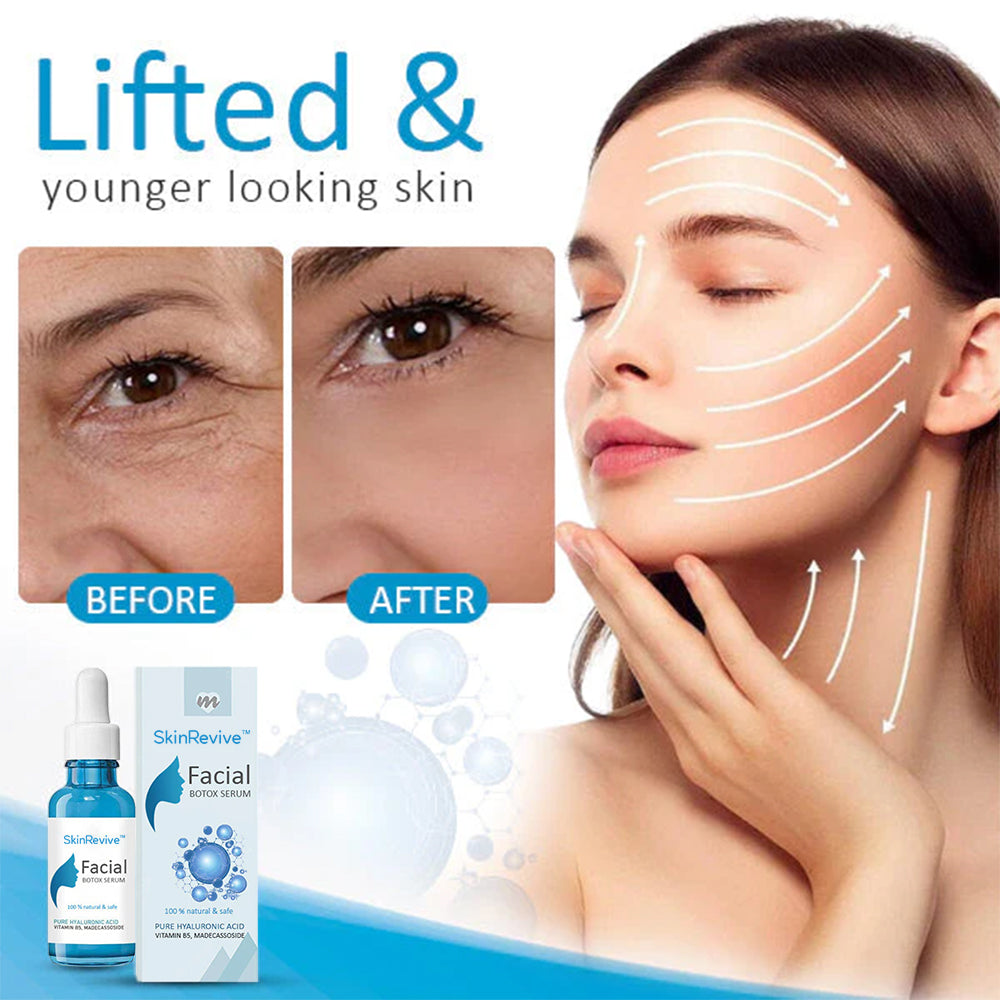 SkinRevive™ Facial Botox Serum - 🔥 LAST DAY SALE 70% OFF 🔥