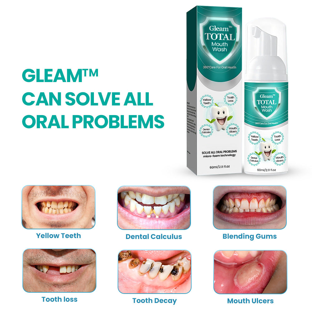 Gleam⢠TOTAL Mouth Wash - Solve all Oral Problems š„ LAST DAY SALE OFF 70% š„