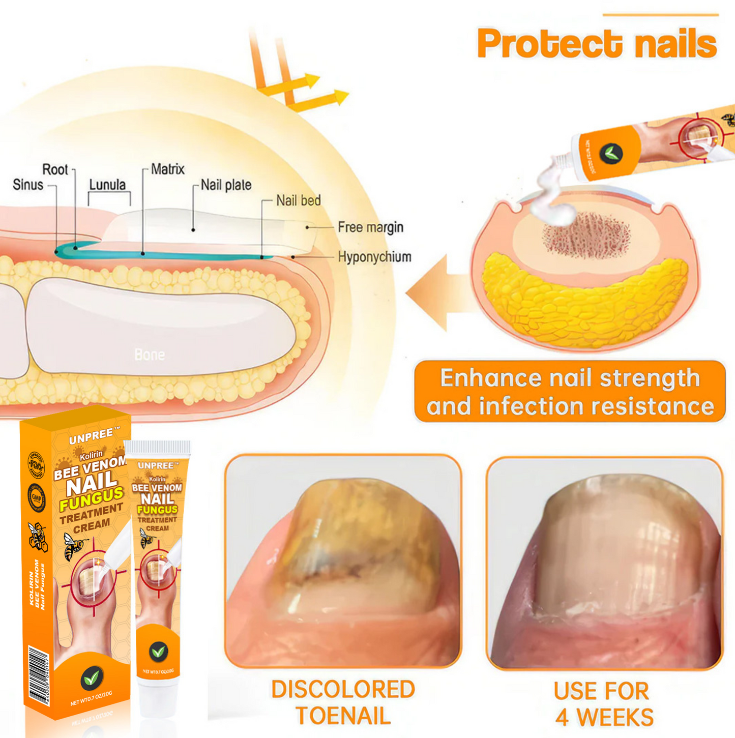 💥2025 Limited 70% OFF⏳UNPREE™ Kolirin Bee Venom Nail Fungus Treatment Cream