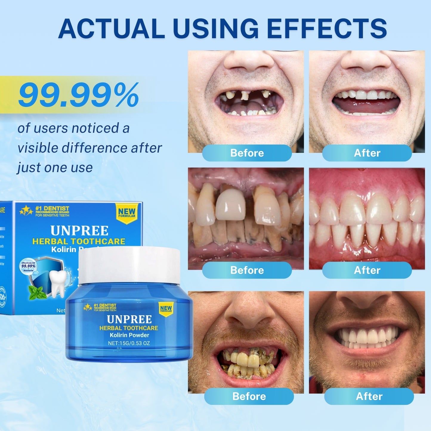 UNPREE™ Herbal ToothCare Kolirin Powder - Solve All Oral Problems 🔥 LAST DAY SALE 70% OFF 🔥