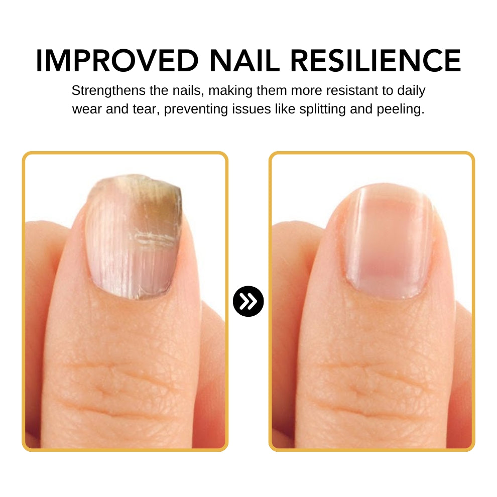 UNPREE™ Kolirin BeeVenom Nail Fungus Solution