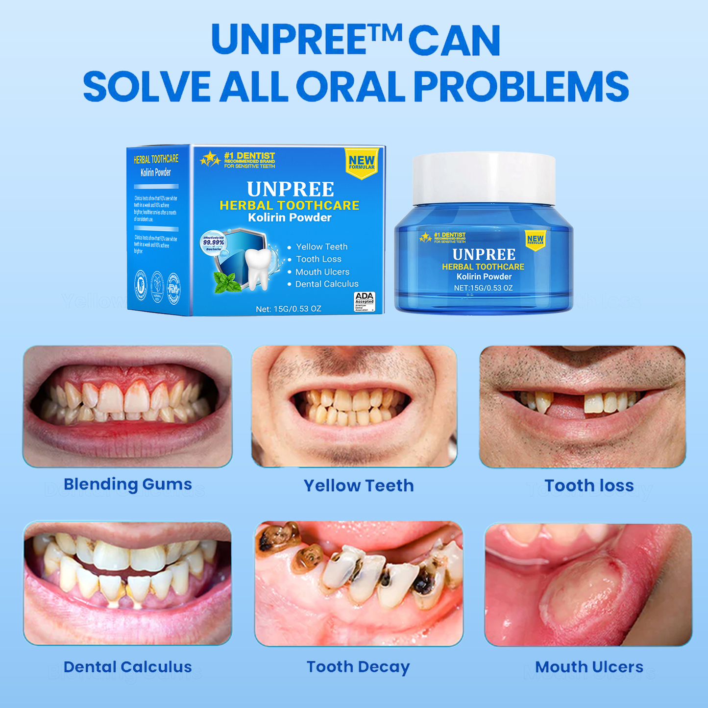 UNPREE™ Herbal ToothCare Kolirin Powder - Solve All Oral Problems 🔥 LAST DAY SALE 70% OFF 🔥