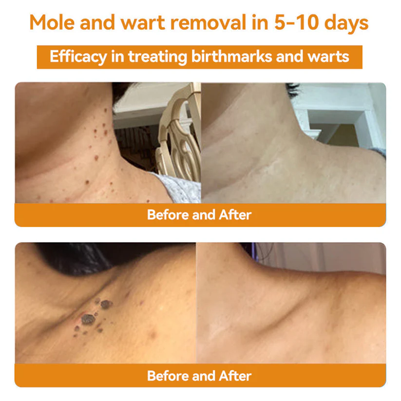 šKolirin⢠Bee Venom Skin Treatment Cream šæLimited Discounts š„
