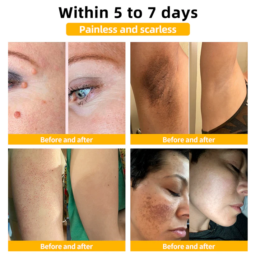 šKolirin⢠Bee Venom Skin Treatment Cream šæLimited Discounts š„