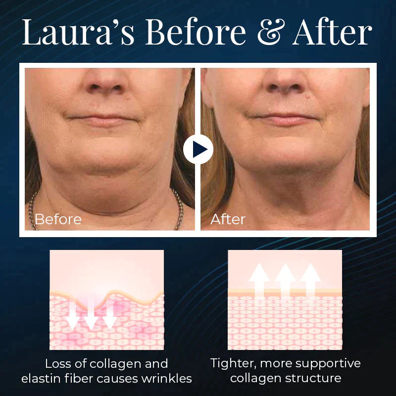NuBeautyPLUS Sleeping V-Face Beauty Device