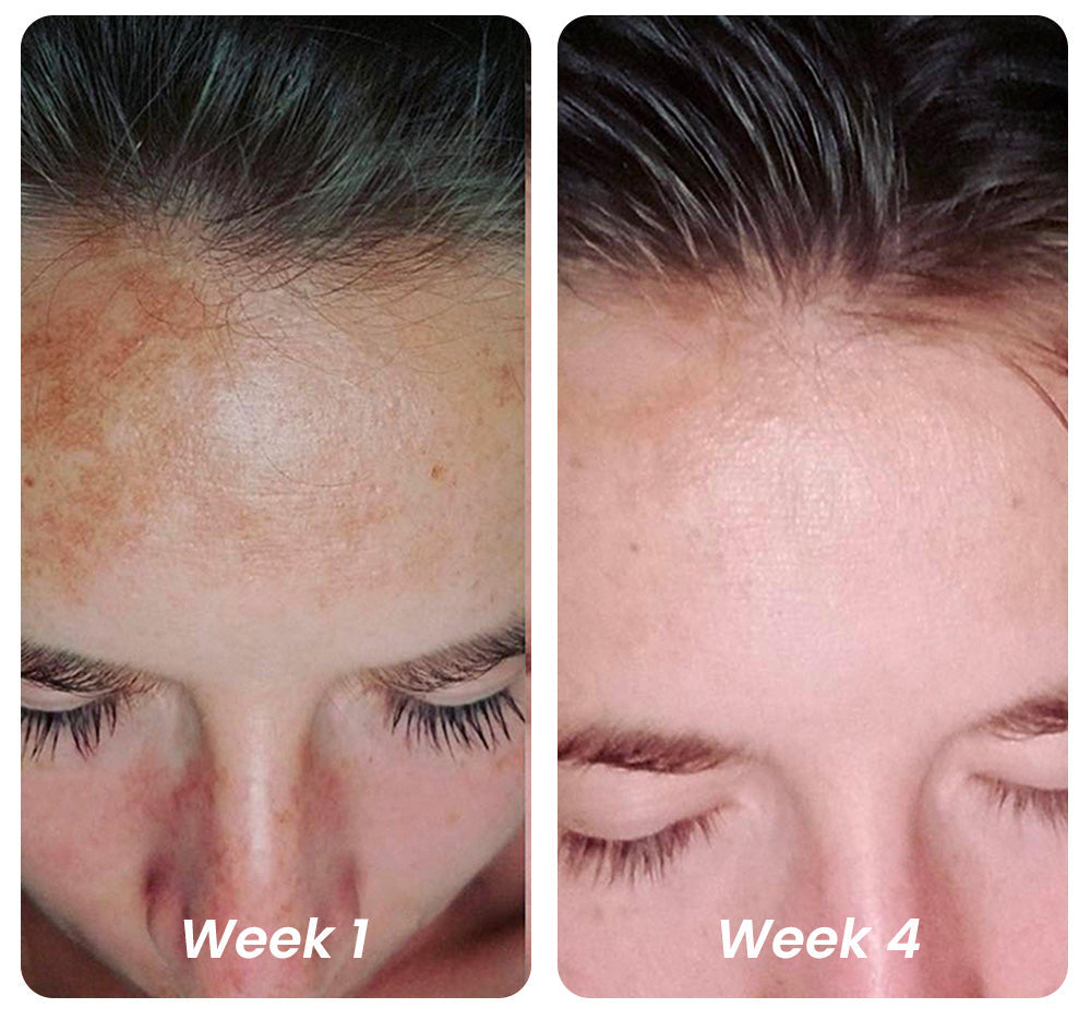 Soomiig™ Pure Vitamin C Dark Spot Correcting Serum