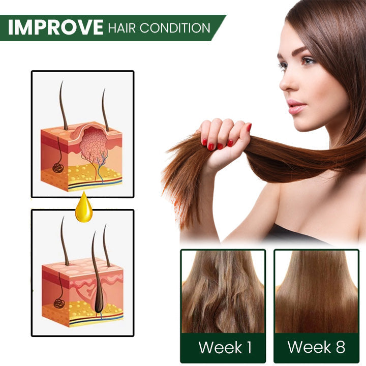 ProX Shouga Essence Hair Growth Oil(Limited Time Discount 🔥 Last Day)