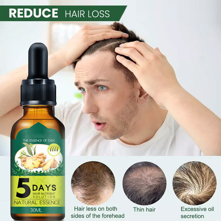 ProX Shouga Essence Hair Growth Oil(Limited Time Discount 🔥 Last Day)