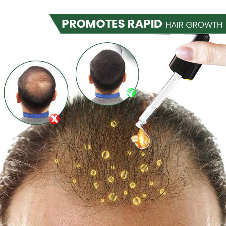 ProX Shouga Essence Hair Growth Oil(Limited Time Discount 🔥 Last Day)
