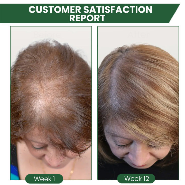 ProX Shouga Essence Hair Growth Oil(Limited Time Discount 🔥 Last Day)