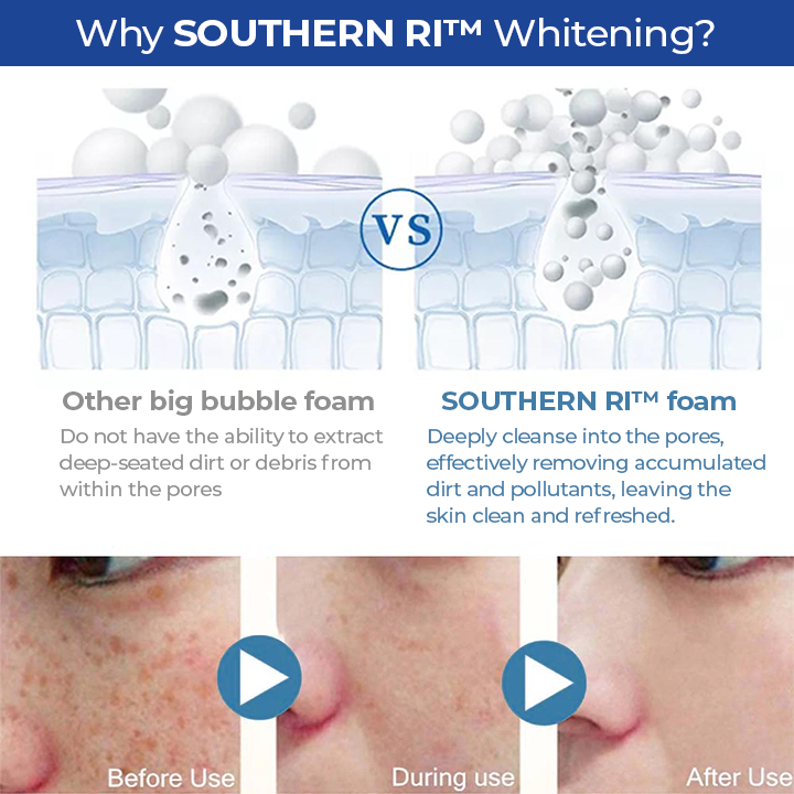 SOUTHERN RI™ Whitening Freckle Removal Cleanser