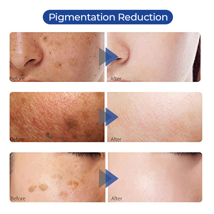 SOUTHERN RI™ Whitening Freckle Removal Cleanser