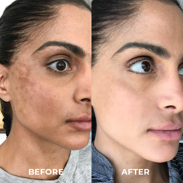 SOUTHERN RI™ Whitening Freckle Removal Cleanser