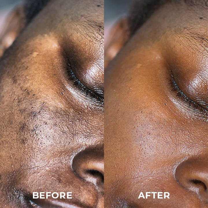 SOUTHERN RI™ Whitening Freckle Removal Cleanser