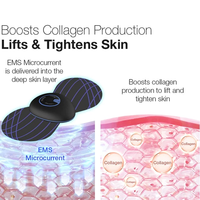 StayUp EMS Microcurrent Massager