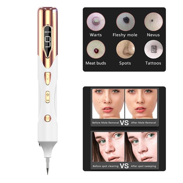 SkinFix Skin Tag Removal Laser Plasma Pen - CERTIFI CURE