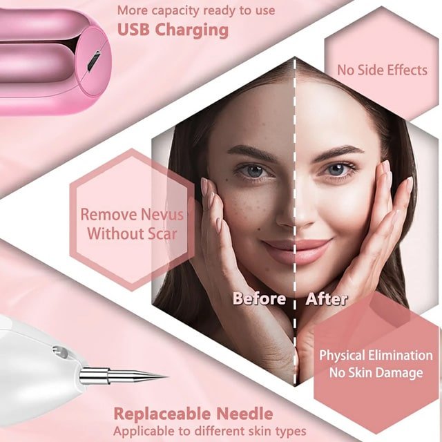 SkinFix Skin Tag Removal Laser Plasma Pen - CERTIFI CURE