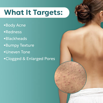 PureBAC™ Back Acne Herbal Spray