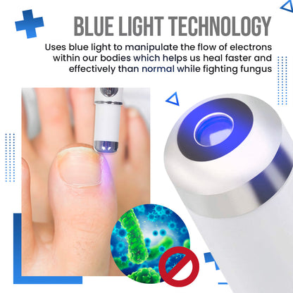 SUPTRUCK™ Anti Fungus Blue Light Laser Pen