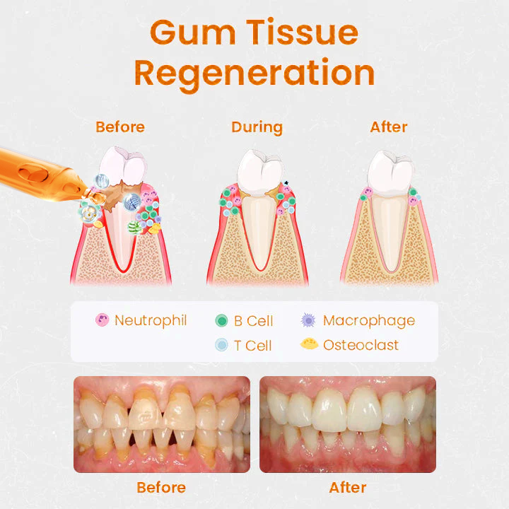 UNPREE™ Gum Repair Treatment Ampoules