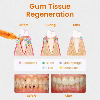 UNPREE™ Gum Repair Treatment Ampoules