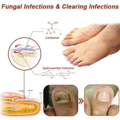 SUPTRUCK™ Revolutionary High-Efficiency Light Therapy Device For Toenail Diseases