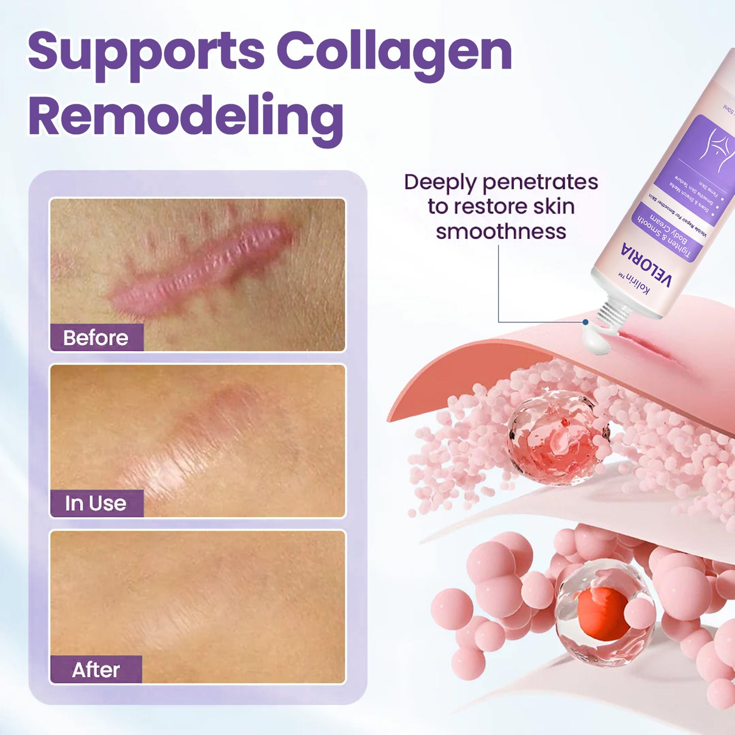 💥 2026 Holiday Sale 70% OFF ✨ KOLIRIN™ Veloria Tighten & Smooth Body Cream For All Scars
