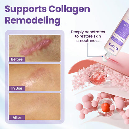 💥 2026 Holiday Sale 70% OFF ✨ KOLIRIN™ Veloria Tighten & Smooth Body Cream For All Scars