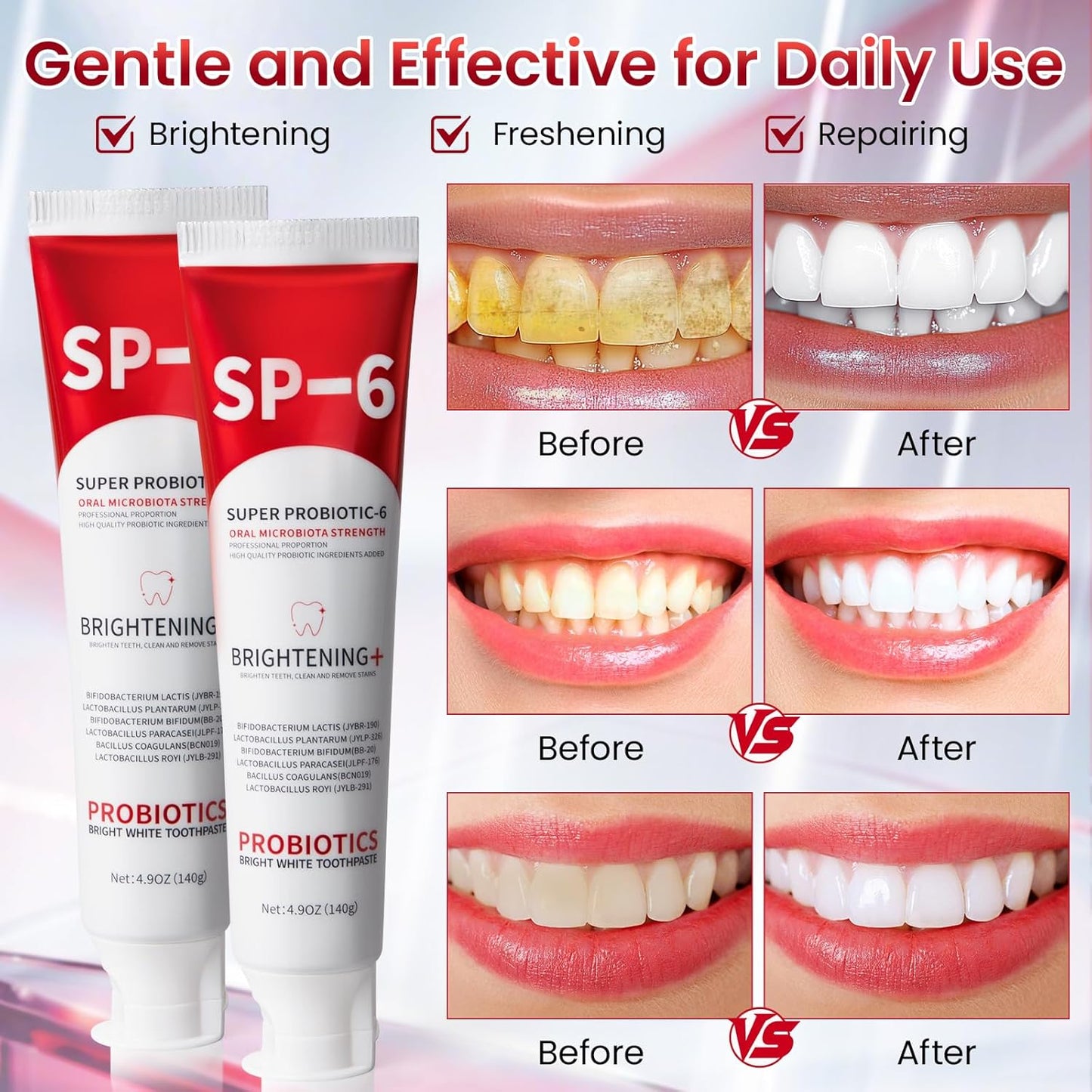 💥 2026 Limited 50% OFF ️🦷 SP-6 Super Probiotic Toothpaste Advanced Oral Care