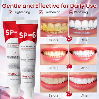 💥 2026 Limited 50% OFF ️🦷 SP-6 Super Probiotic Toothpaste Advanced Oral Care