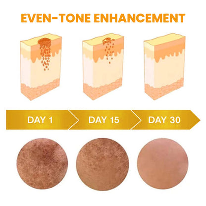 💥 Summer Sale 70% OFF ⏳ UNPREE™ Bee Bright Kolirin Advanced Brightening Cream