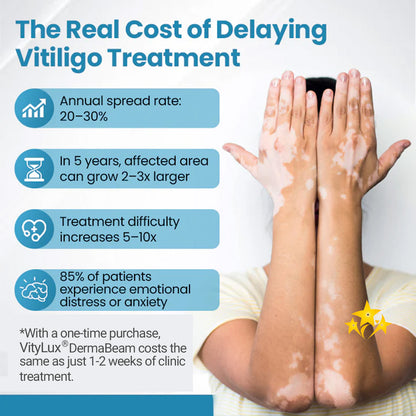 💥 VityLux® DermaBeam Vitiligo Laser Therapy System 🔆 3-5 Seconds Vitiligo Treatment - 2 Weeks To Visibly Better Skin