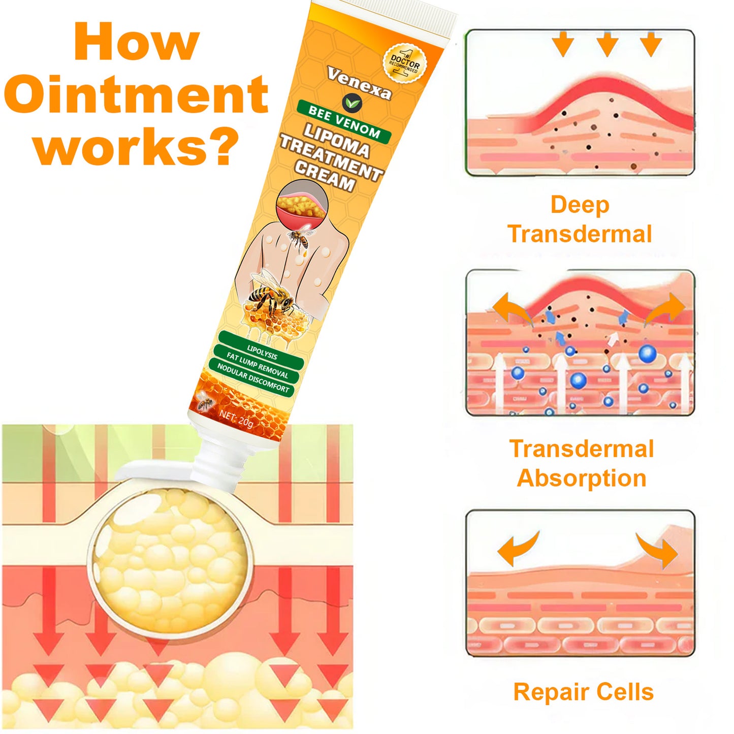 🎉 2025 Upgraded 75% OFF 🐝 Venexa™ Bee Venom Lipoma Treatment Cream 🌿 Visible Results in 2 Weeks!