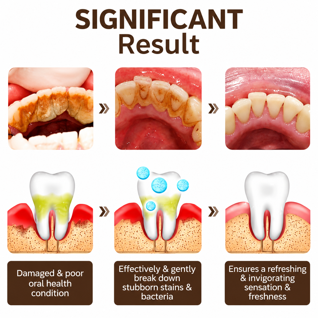 💥 2026 Limited 50% OFF ️🦷 SP-6 Super Probiotic Toothpaste Advanced Oral Care