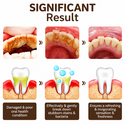 💥 2026 Limited 50% OFF ️🦷 SP-6 Super Probiotic Toothpaste Advanced Oral Care
