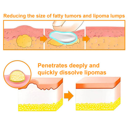 🎉 2025 Upgraded 75% OFF 🐝 Venexa™ Bee Venom Lipoma Treatment Cream 🌿 Visible Results in 2 Weeks!