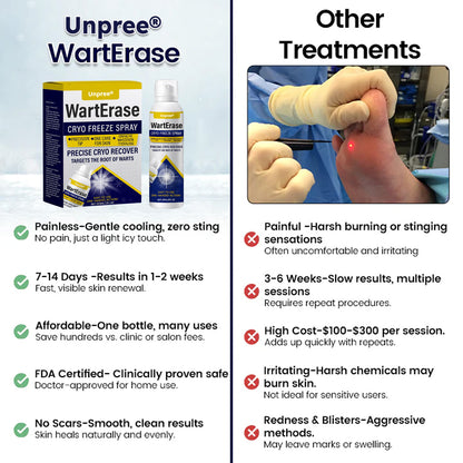 🔥 2026 Holiday Sale 70% OFF ✨ Unpree® WartErase Cryo Freeze Spray